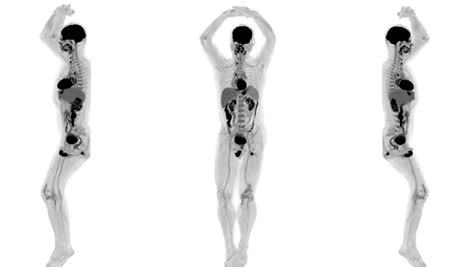 Explorer: World's First Full-Body 3D Scanner