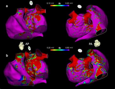 An 82-year-old woman without significant cardiac history presented ...