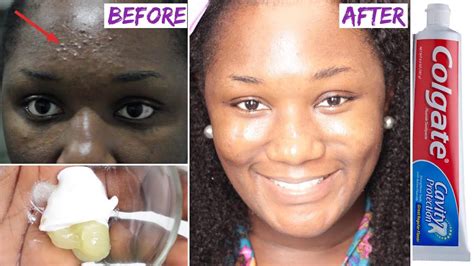 What happens when you mix toothpaste with Vaseline? – Fabalabse