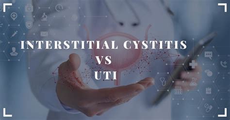 Interstitial Cystitis vs UTI - Nutri Inspector