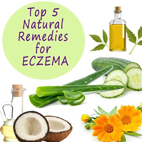 Top 5 Natural Remedies for Eczema (With images) | Natural eczema ...