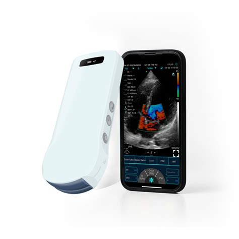 Benefits of handheld wireless ultrasound machine