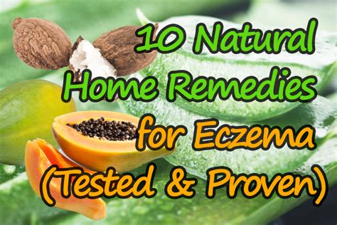 10 Natural Home Remedies for Eczema (Tested & Proven) - Cure Eczema Slowly