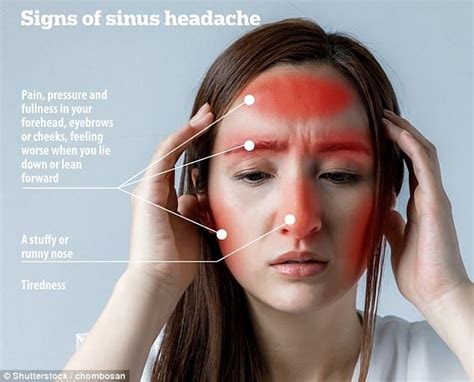 Not all headaches feel the same, handy picture guide shows | Sinus headache symptoms, Forehead ...