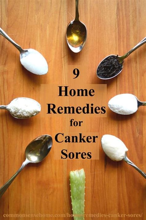 9 Home Remedies for Canker Sores & Tips to Avoid Canker Sore Triggers ...