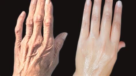 HOW TO REMOVE WRINKLES ON YOUR HANDS. Clear The Hand ROUGHNESS And DRYNESS | Wrinkle remover ...