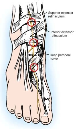 deep peroneal nerve – Liberal Dictionary