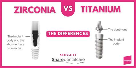 Zirconia vs Titanium Implants: The Differences - Zeramex USA