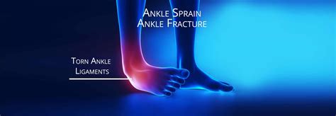 Ankle Sprain - Ankle Fracture - Torn Ligament or Tendon - Self Healing Course - Healing Courses ...