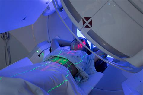 Radiation Therapy: MedlinePlus