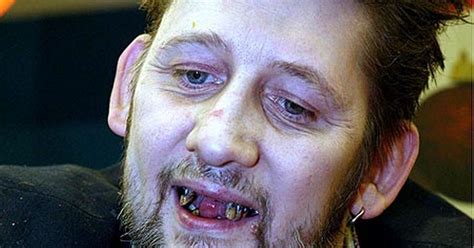 Fairytale of new TEETH! Shane MacGowan displays impressive new gnashers at charity bash - Mirror ...