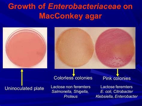 Can Gram Positive Bacteria Grow on Macconkey Agar - Thalia-has-Grimes