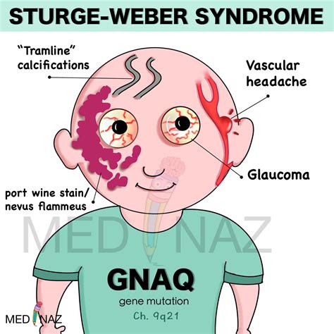 Dental Exam - Sturge-Weber Syndrome