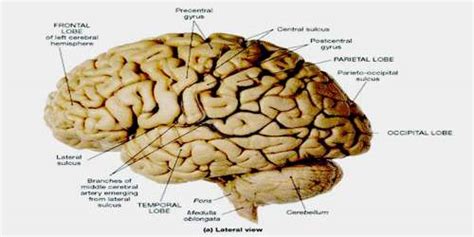 Lateral Sulcus - Assignment Point