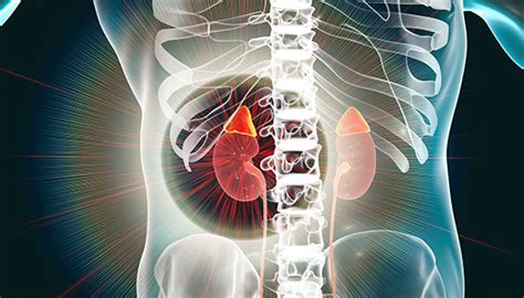 Adrenocortical Carcinoma | Johns Hopkins Medicine