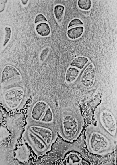 Difference Between Chondroblasts and Chondrocytes | Definition, Characteristics, Function ...