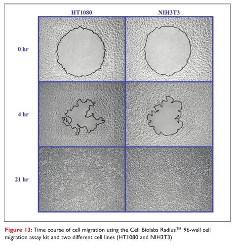 Cell Migration: Probing Cell Movement With Smarter Tools - Drug ...