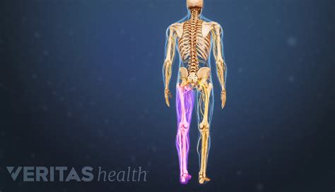 Degenerative Scoliosis Symptoms and Diagnosis | Spine-health