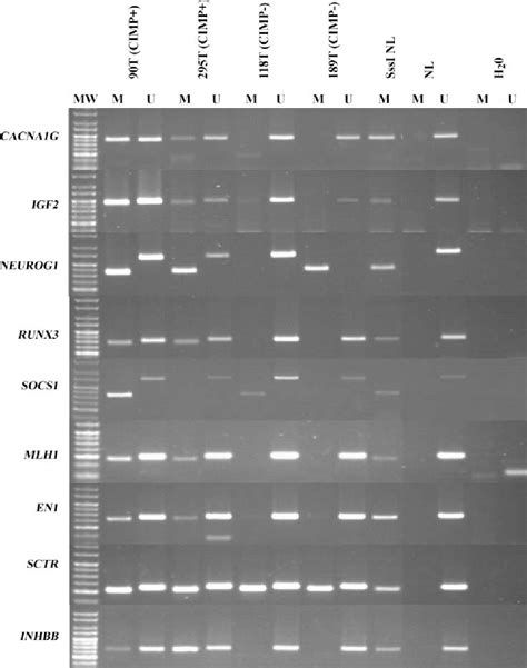 Figure 1 from The CpG Island Methylator Phenotype Correlates with Long-Range Epigenetic ...