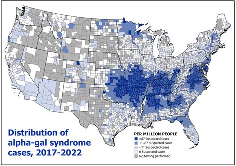 Kentucky is hot spot for alpha-gal syndrome, a red meat allergy