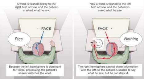 Split Brain Experiment on emaze