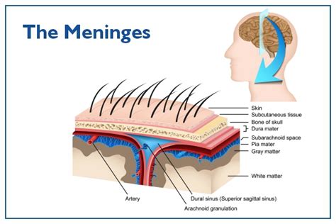 Meningitis: Symptoms, Causes, Prevention, Treatment