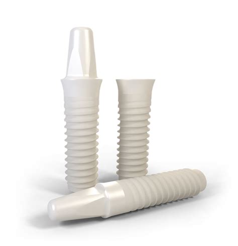 Ceramic Dental Implants - Durham Dental Solutions