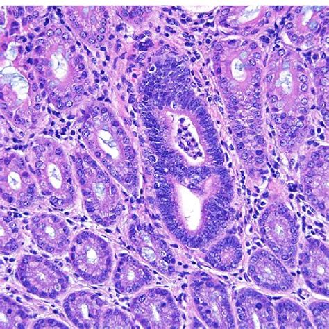 Multiple cell types are present in adenomas in Apc Min/+ and related... | Download Scientific ...