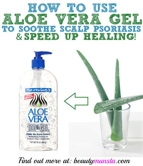 Aloe Vera on Scalp Psoriasis | Does it Work? - beautymunsta - free natural beauty hacks and more!