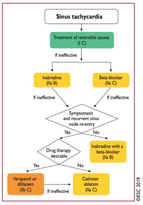 Sinus Tachycardia - Cardio Guide