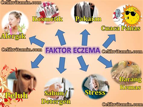 Rawatan Penyakit Eczema Supaya Kulit Kembali Sihat | Tips Sihat Ceria