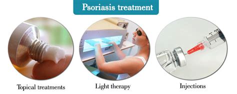 Psoriasis : Symptom, Causes, Types & Treatment » How To Relief