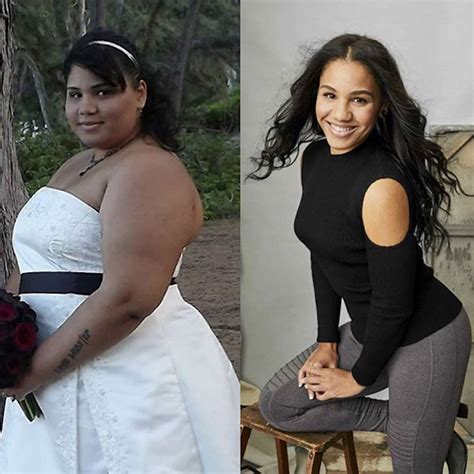 Sunrise Weight Loss Story Today 2024 - Leora Noelani