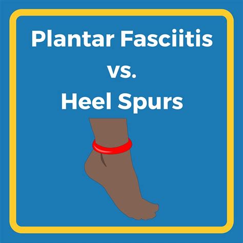 Plantar Fasciitis vs. Heel Spurs | Heel That Pain