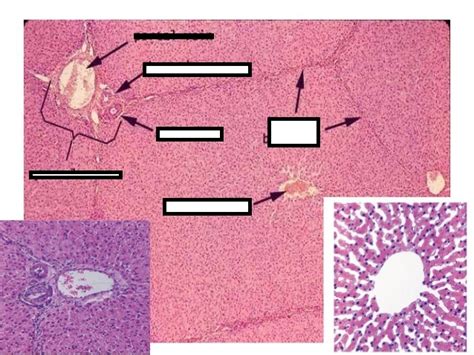 Liver histology\ Diagram | Quizlet