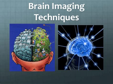 Brain Imaging Techniques