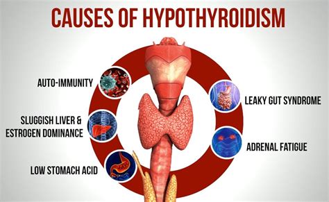 Hypothyroidism: How Is It Different From Hyperthyroidism?