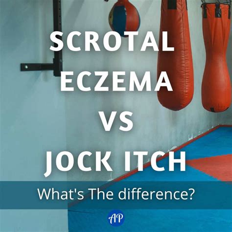 Scrotal Eczema vs Jock Itch: What's The Difference?