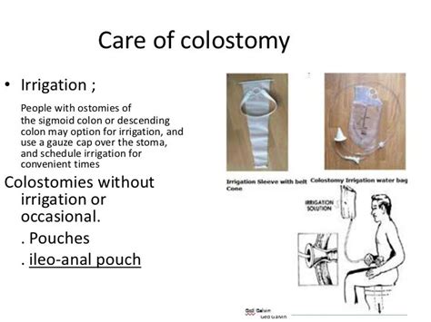 Colostomy