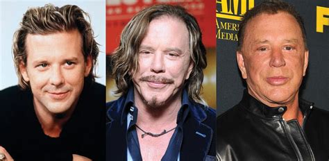 Mickey Rourke Plastic Surgery Before After