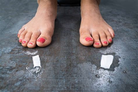 Sweaty Feet: Causes, Treatments and Information | Podiatrist in Visalia