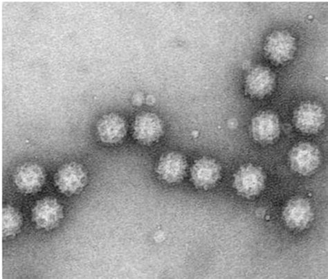 Mystery sapovirus strikes nursing homes, new tests reveal