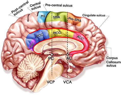 Frontiers | Surgical techniques and function outcome for cingulate gyrus glioma, how we do it