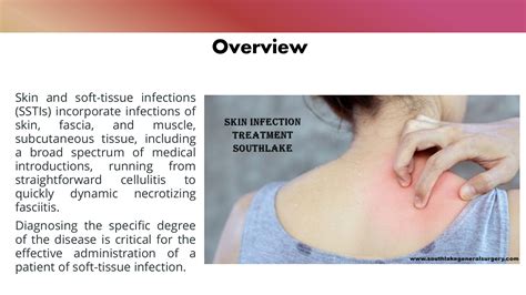 Skin And Soft Tissue Infections- Diagnosis and Treatment - Southlake General Surgery - Page 2 ...