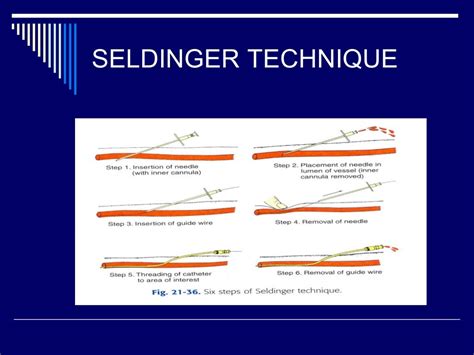 Angiography basics and seldinger technique