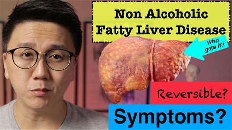 NAFLD/NASH Symptoms | How to Reverse Fatty Liver Disease - YouTube