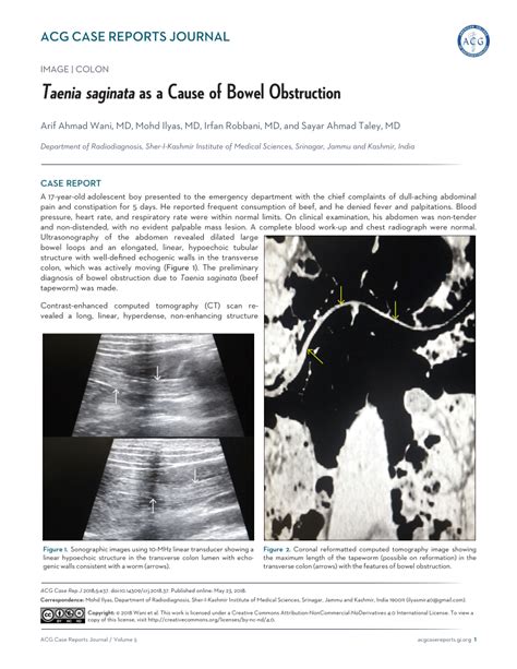 (PDF) Taenia saginata as a Cause of Bowel Obstruction