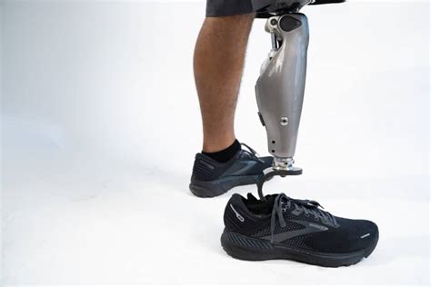 Lower Limb Prosthesis - Pongratz Orthotics & Prosthetics