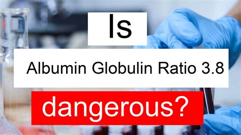 Is Albumin Globulin ratio 3.8 high, normal or dangerous? What does A/G ratio level 3.8 mean?