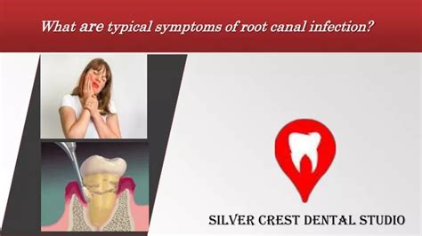 PPT - What are typical symptoms of root canal infection ? PowerPoint ...